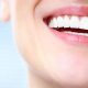 شرایط ایمپلنت دندان ها
