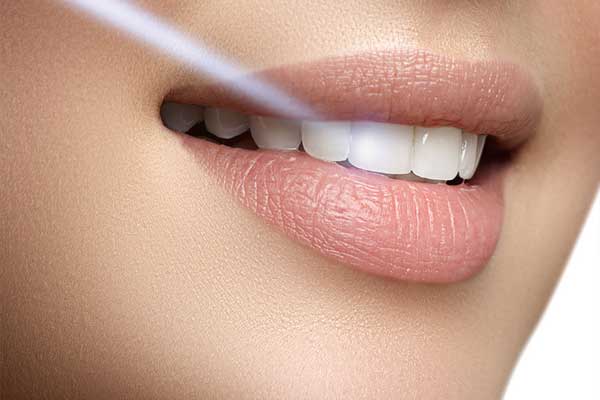 مزایای لیزر در دندانپزشکی زیبایی