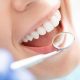 عوارض سفیدکردن دندان ها
